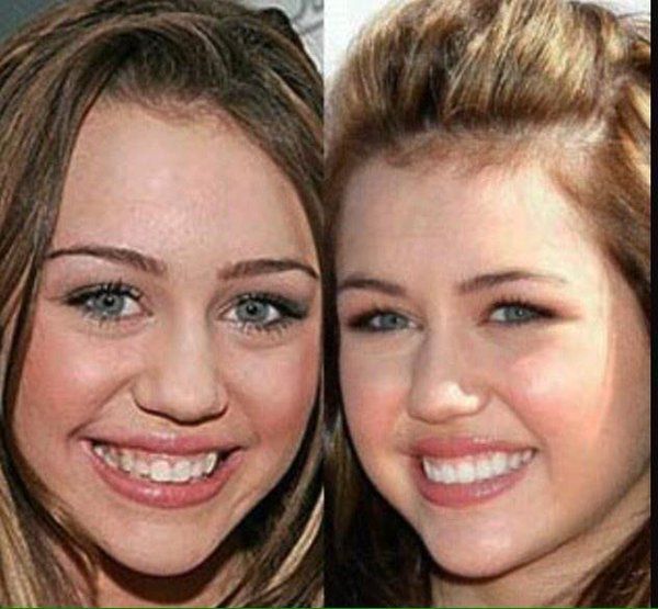 Duas mulheres sorridentes: uma com cabelo castanho, a outra com cabelo loiro. Comparação lado a lado.