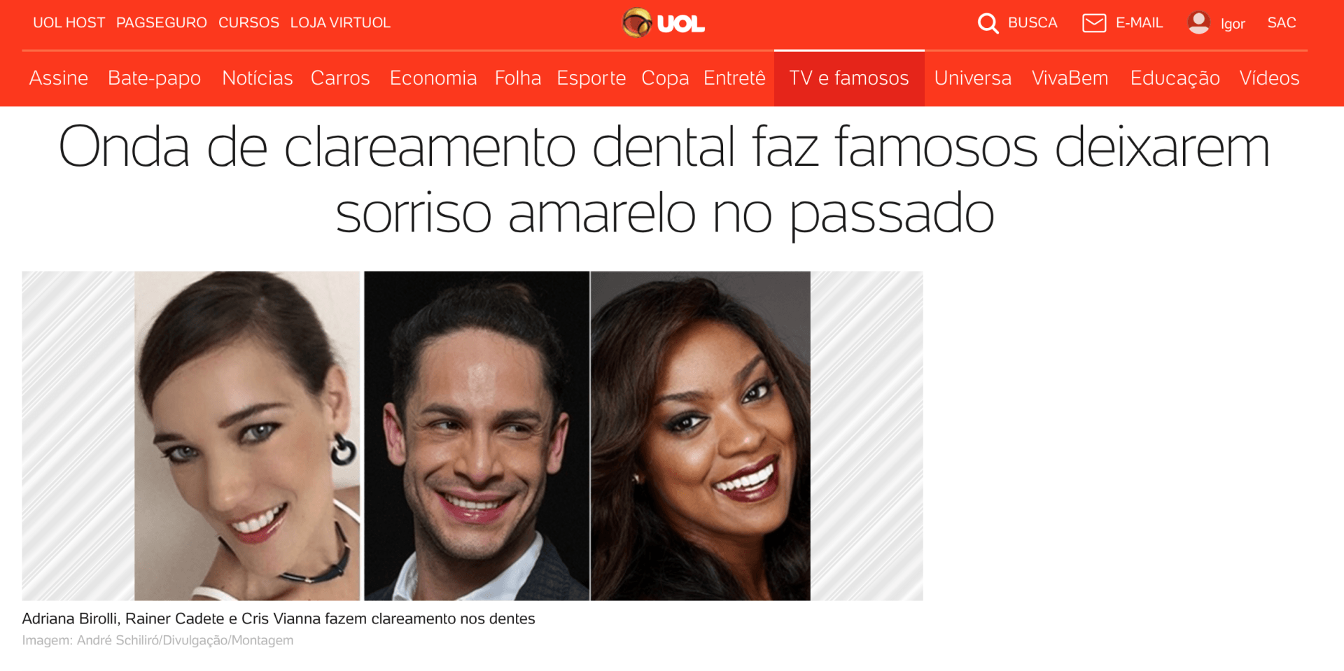 sorriso de famosos clareamento dental