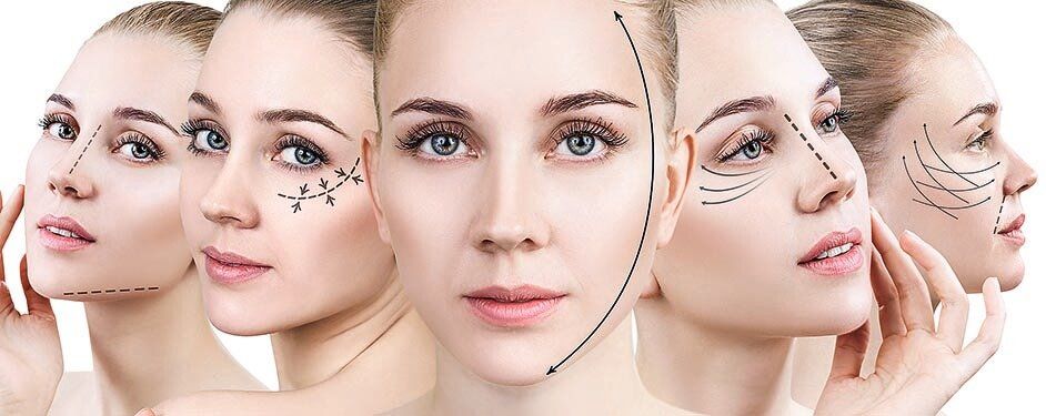 Vues multiples d'un visage avec des lignes indiquant des interventions de chirurgie esthétique.