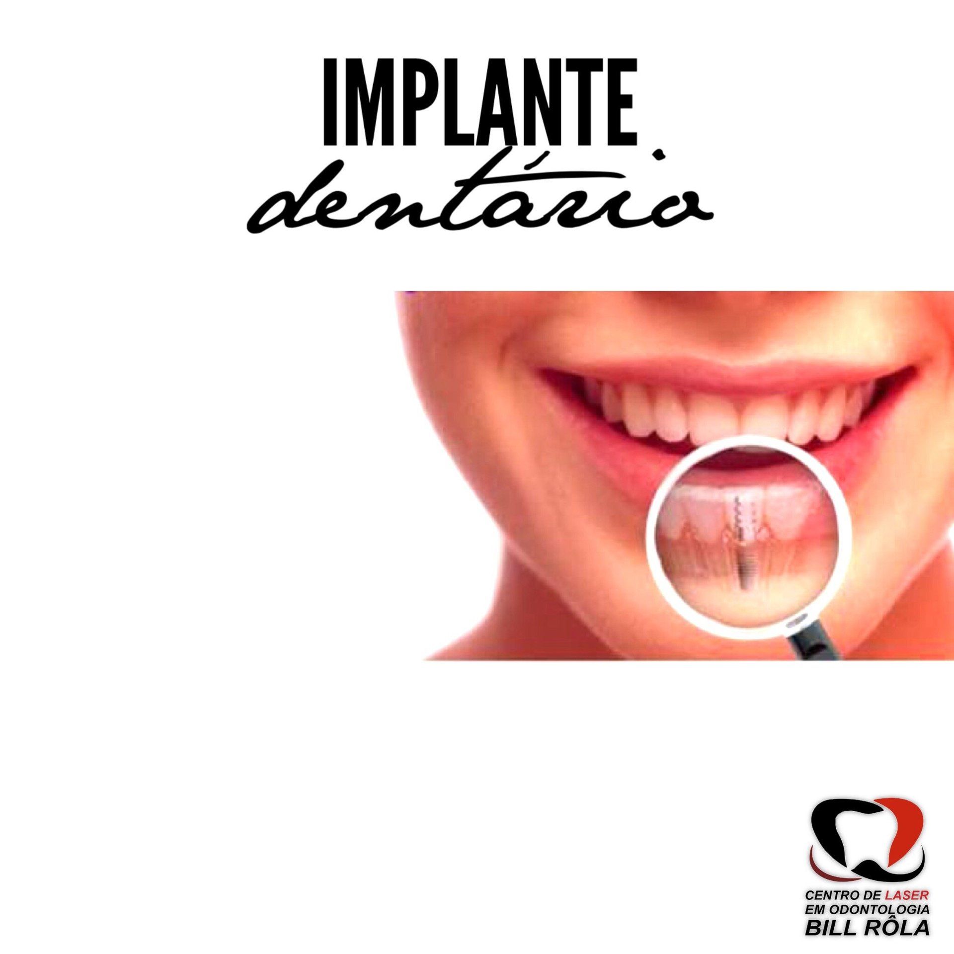Advertisement: Woman smiling, dental implant detail magnified. Text: 