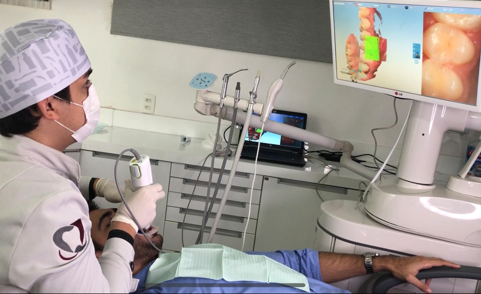 lente de contato sob dente Il dentista esegue la scansione della bocca del paziente con uno scanner digitale; le immagini dei denti sono sul monitor, il paziente è sdraiato sulla poltrona del dentista.