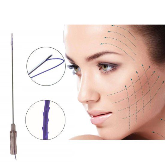 Rosto de mulher com linhas pontilhadas e uma agulha de lifting com fios, destacando o procedimento cosmético antienvelhecimento.