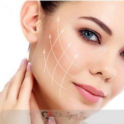 Rosto de mulher com linhas brancas e setas indicando um procedimento de lifting facial.