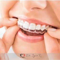 Pessoa inserindo alinhador dentário transparente na boca.