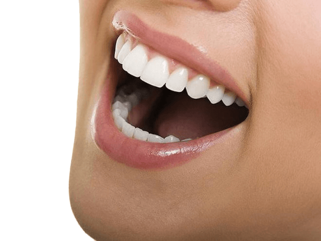 Close-up of a smiling mouth with bright white teeth and pink lips, against a white background.