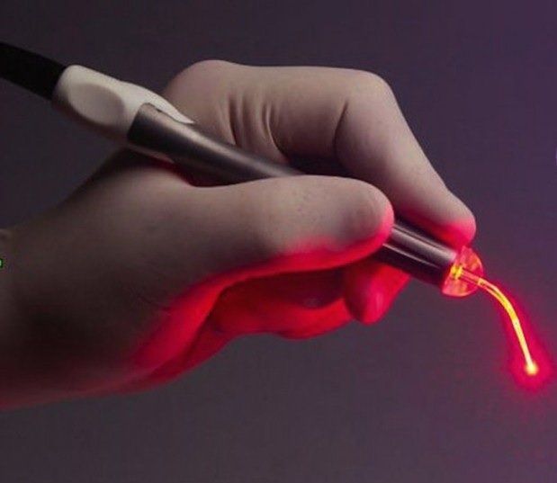 uso de um dispositivo tecnológico em fortaleza para melhorar a técnica de Gengoplastia ou Gengivectomia, bisturi eletrônico para cirurgia gengival