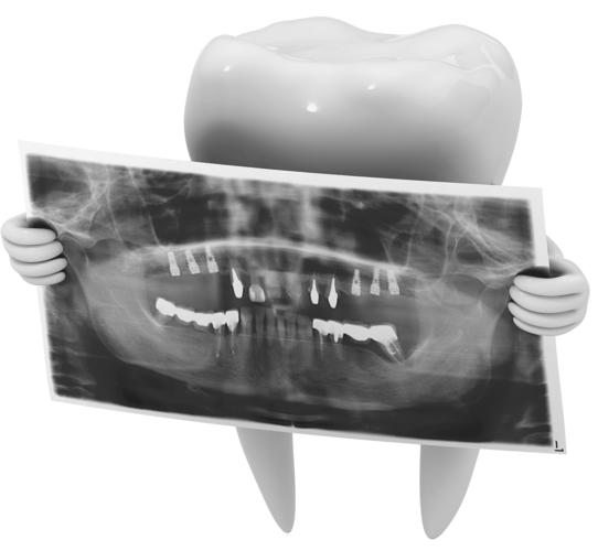 lente de contato dental x lente de contato lentes de contato dental tratamento etético odontológico para dentes, odontologia estética em fortaleza ceara