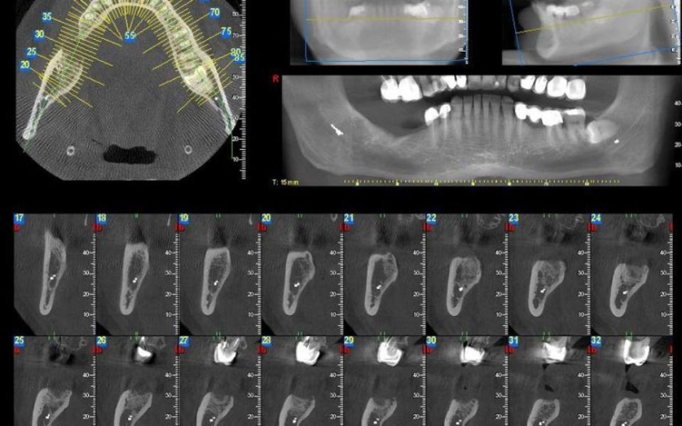 Radiologia digitale e odontoiatrica