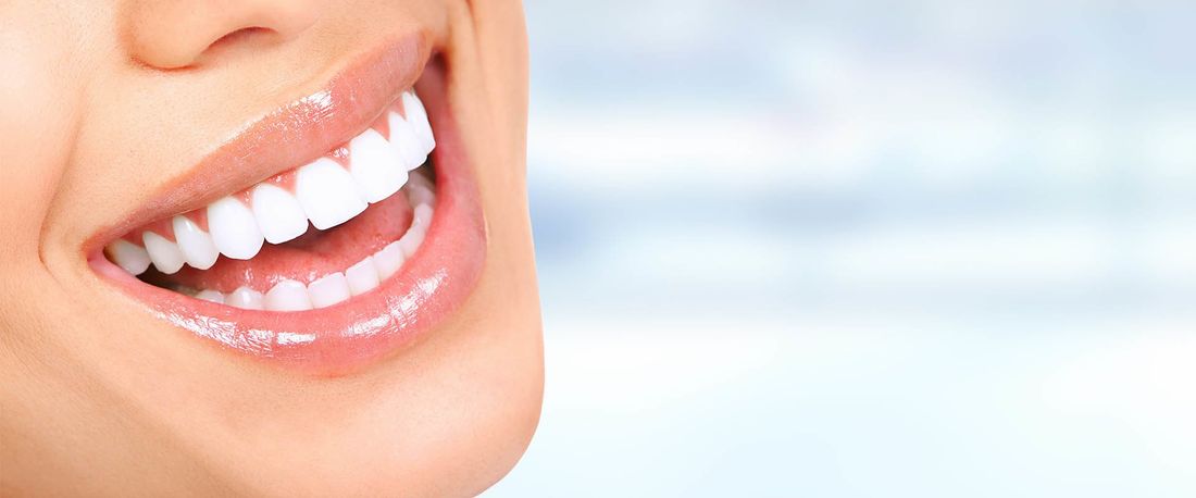 Un trattamento di sbiancamento dentale