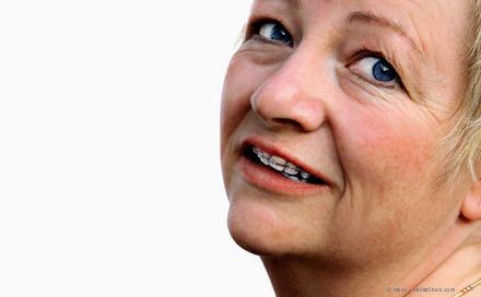 Eine kieferorthopädische Behandlung bei Erwachsenen ist in jedem Alter möglich. Eine kieferorthopädische Behandlung bei Erwachsenen ist in jedem Alter möglich.