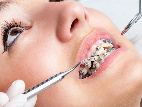 L'ortodonzia e gli apparecchi dentali L'ortodonzia e gli apparecchi dentali
