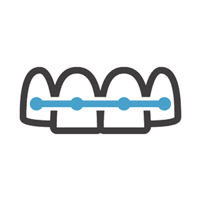 braces grange dental clinic cosmetic dentistry
