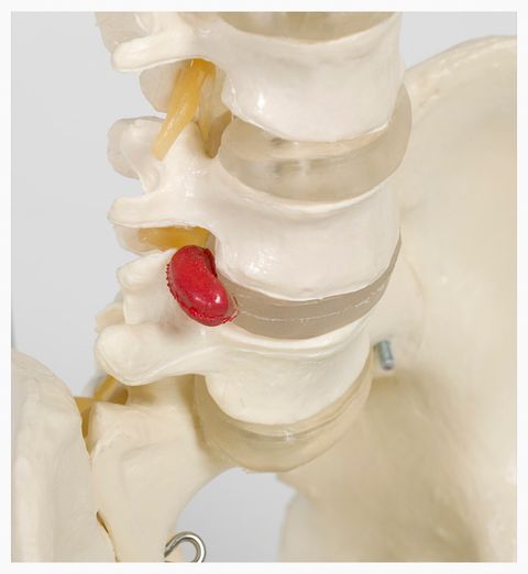 Image of a spine