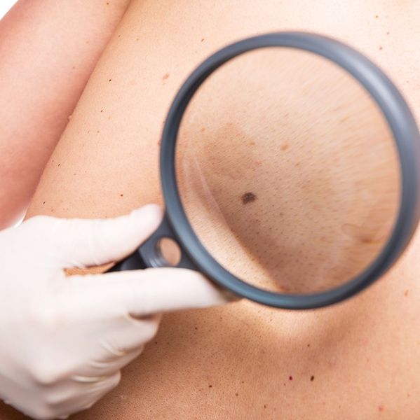 Skin Treatment
