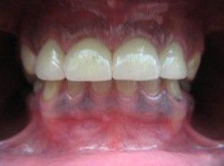 Patient Smile After