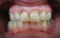 Patient Smile Before 