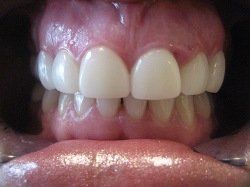 Patient Smile After
