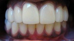 Patient Smile After