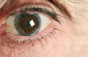 Eye Disease