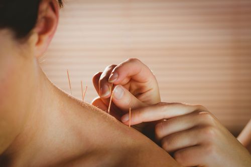 accupuncture