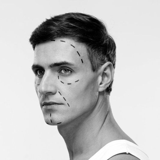 Plastic Surgery for Men - Dr Ehren Eksteen Plastic Surgeon Pretoria