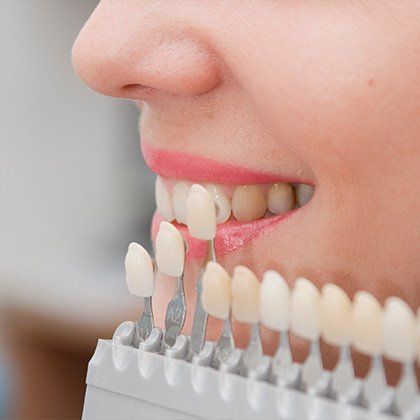 dental crowns close up