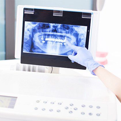 dental imaging