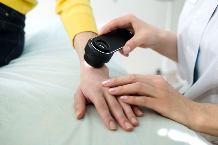 dermatologa che controlla dei nei ad una donna
