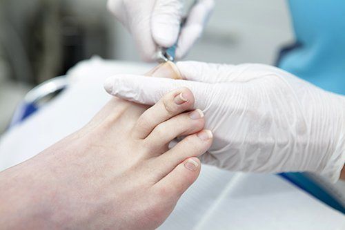Toe Nail Cutting by expert 