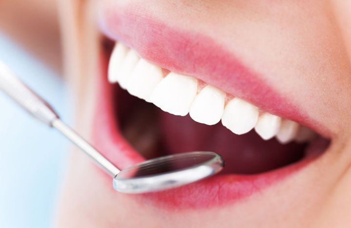 Denti smacchiati