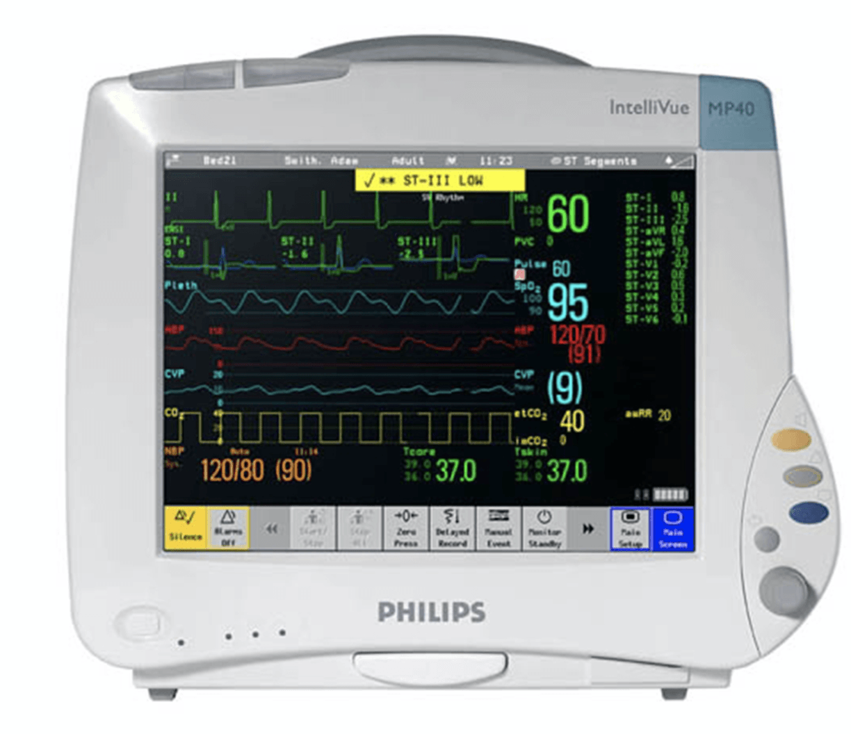 Philips Patient Monitor
