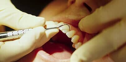 Teeth on Pain - tooth care in Portland, OR