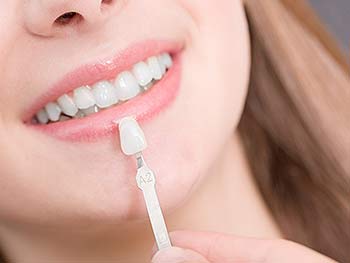 Hempstead Smiles Our Services