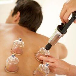 Add Ons: Cupping Therapy Add Ons: Cupping Therapy