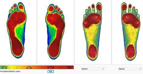 foot examination and computerized laser foot scanner from Foot Levelers Inc.