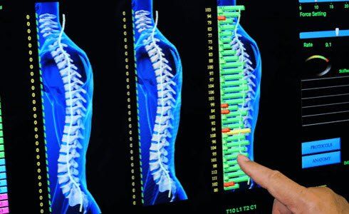 Living Well Chiropractic Clinic PulStar system