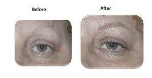 before and after
