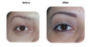 before and after