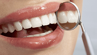 prestazioni odontotecniche specialistiche Dentista Genova
