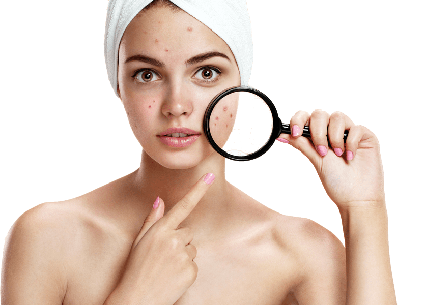 ROUTINE PEAU ACNEIQUE ALOE VERA ESSENTIEL NATURE COSMÉTIQUE
