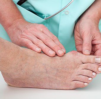 Podiatric doctor diagnosing the feet problem that the patient faces