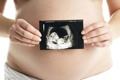 una donna che mostra il risultato di un'ecografia