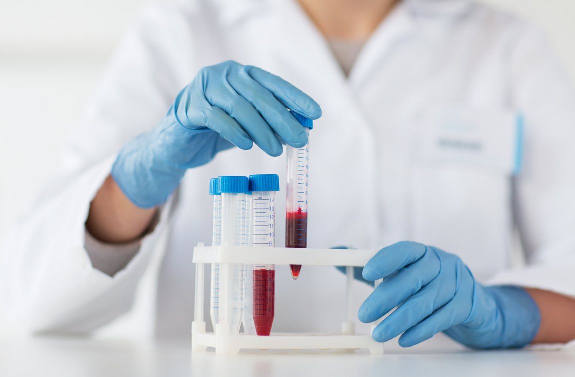 Campioni di sangue per analisi di laboratorio