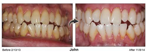 Orthodontic — John Teeth and Gums in Cleveland, OH