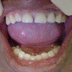 Open mouth showing upper and lower teeth, with tongue extended and mouth wide open.