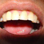 Close-up of a smiling mouth with a tongue sticking out, showing teeth and pink lips.