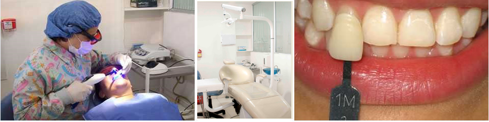 Dentist working on a patient in a clinic beside a close-up of teeth with a shade guide
