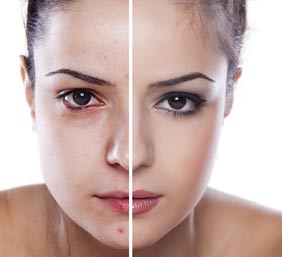 before and after treatment