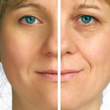 woman before and after 