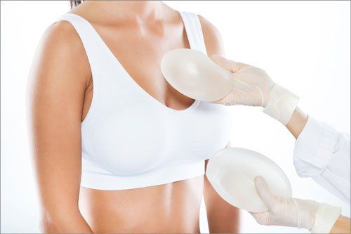 Female doctor choosing mammary prosthesis with her patient